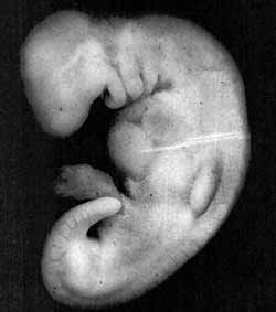 Scientific Miracles Holy Quran :the stages mans embryonic development: